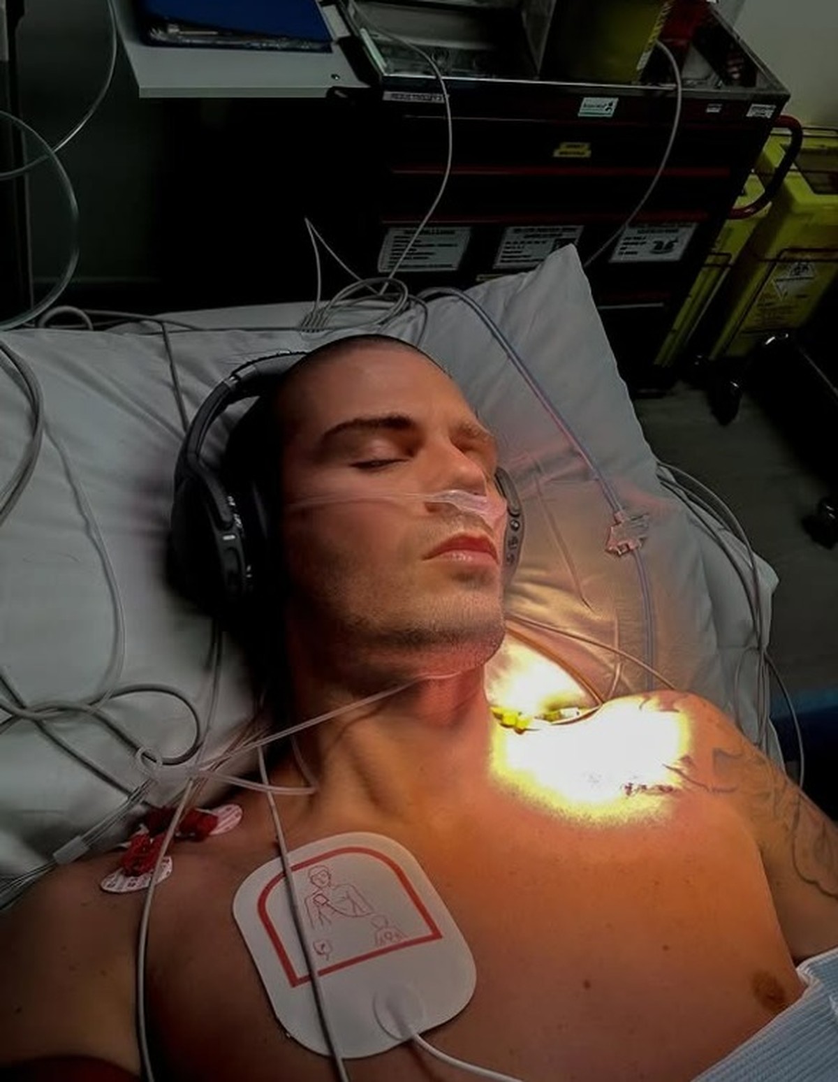 Max George: Atualização de Saúde Após Cirurgia Cardíaca de Marcapasso