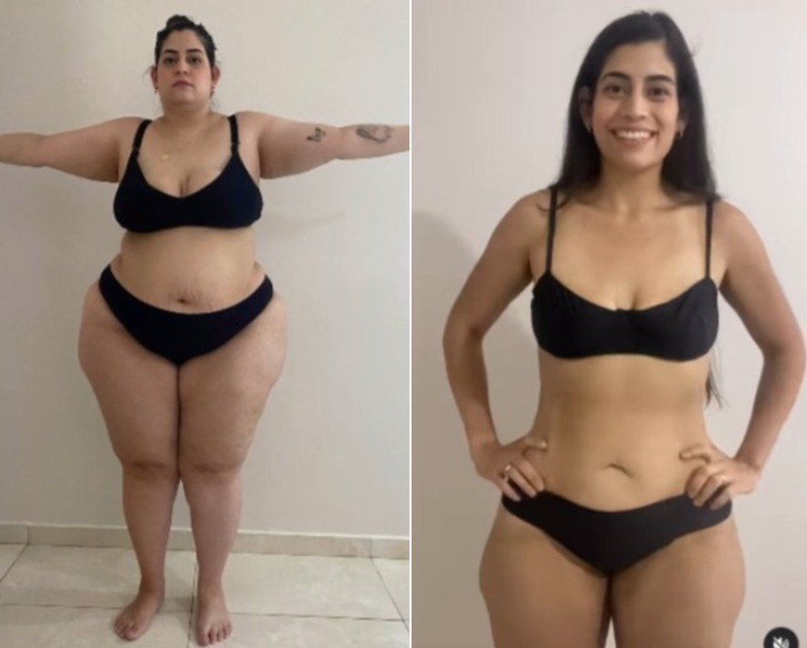 Transformação impressionante antes e depois