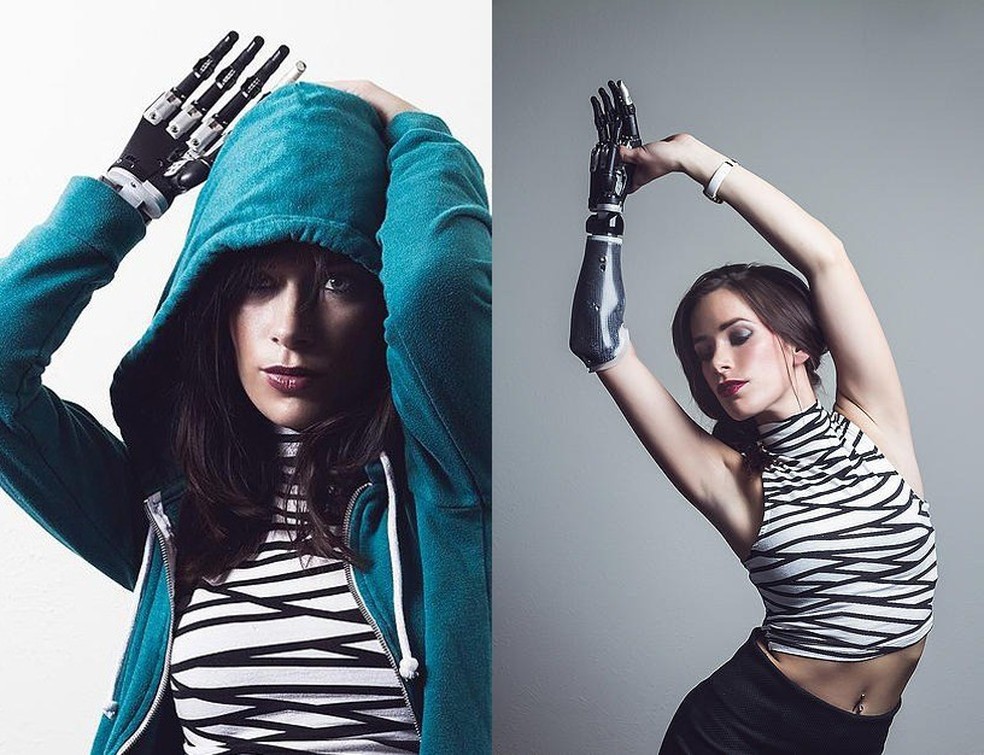 Modelo com braço biônico cruzará a passarela da semana de moda de NY