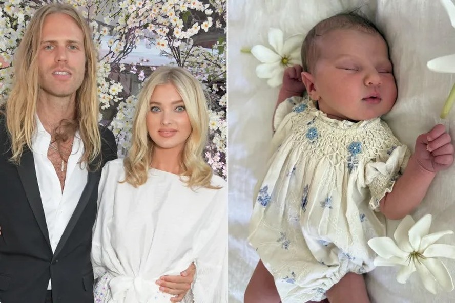Supermodelo Elsa Hosk anuncia o nascimento da segunda filha com Tom Daly