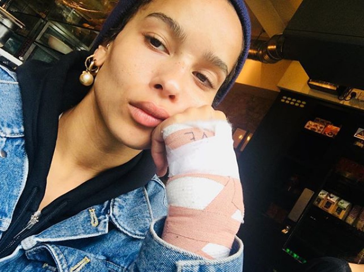 Zoe Kravitz insinua que se envolveu em briga em foto com mão quebrada