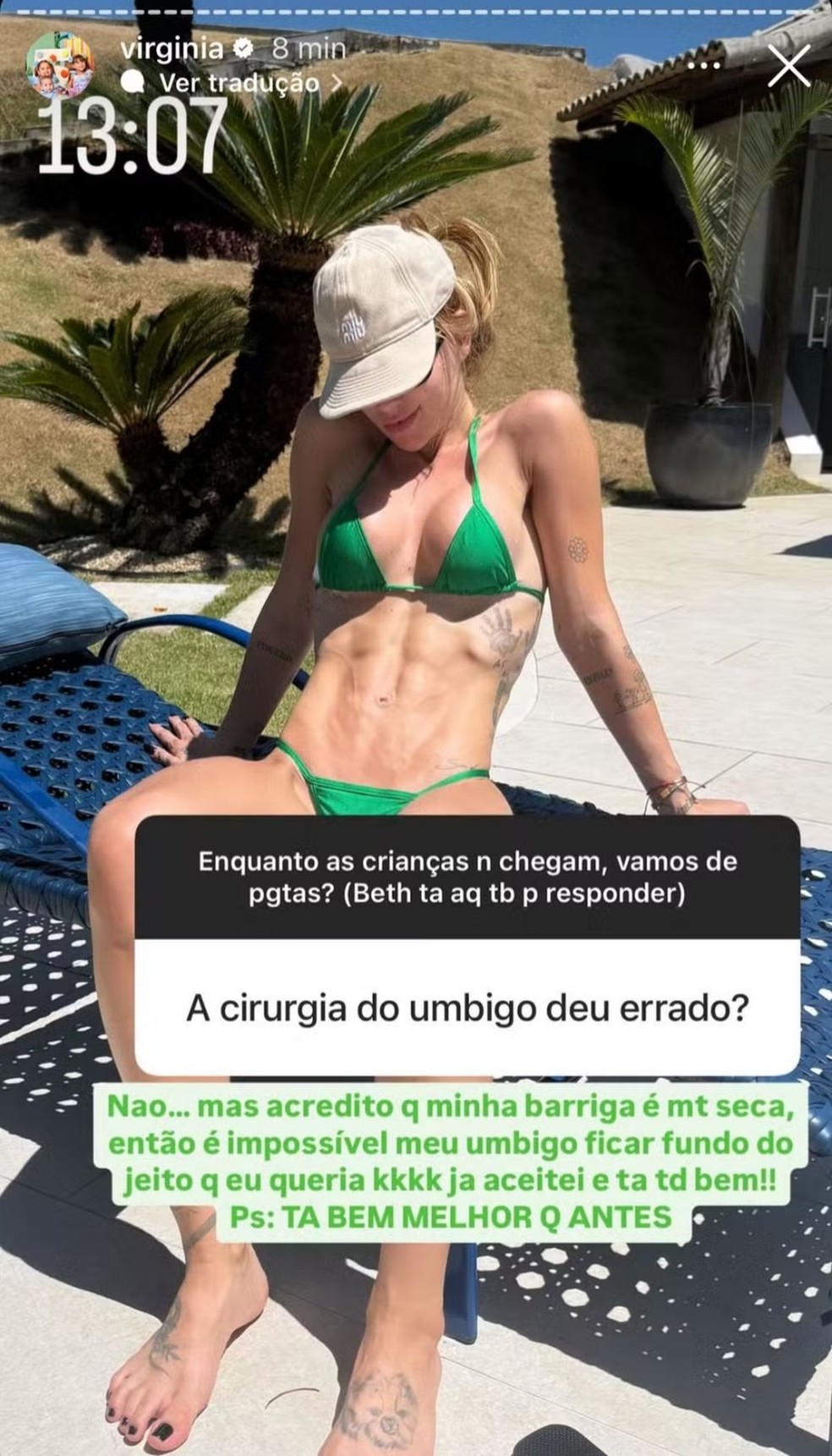 Virginia Fonseca fala sobre cirurgia no umbigo — Foto: Reprodução/Instagram