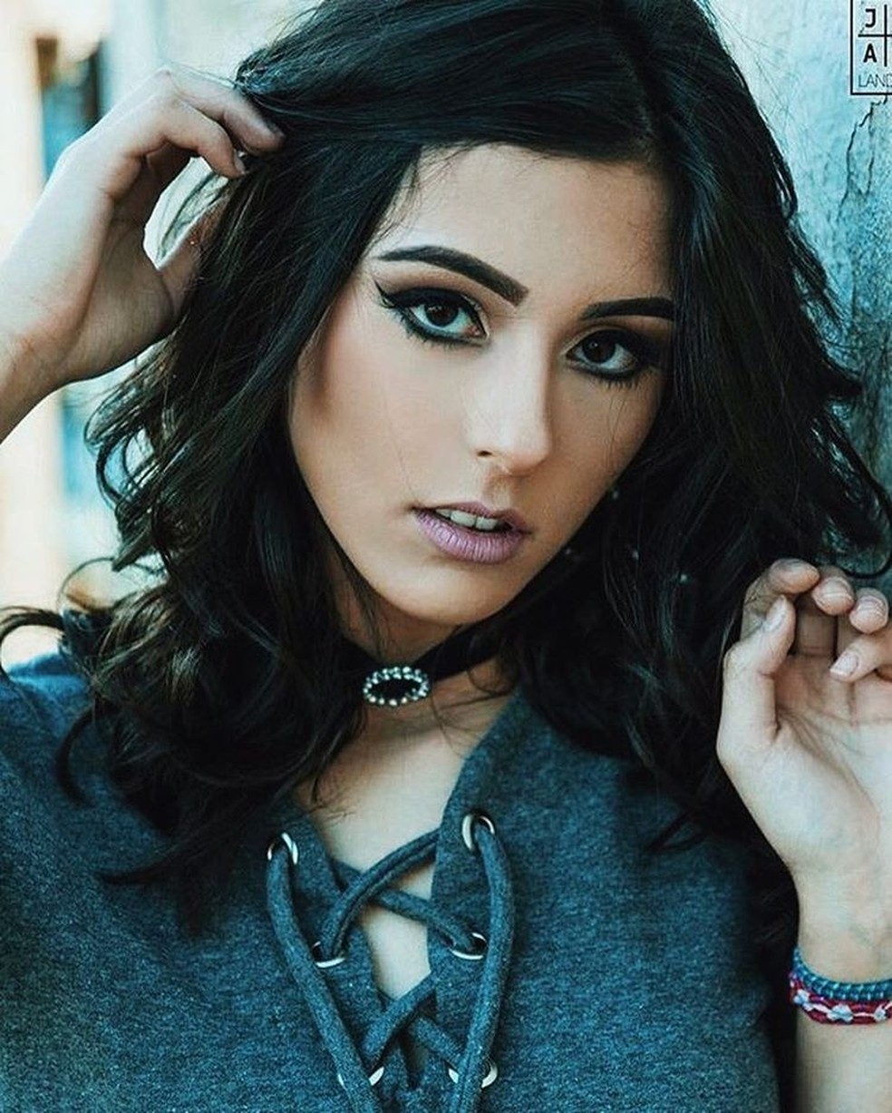 giovanna-lancellotti-compartilha-clique-de-irm-mais-nova