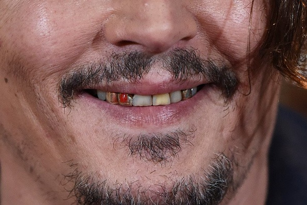 Johnny Depp revela sorriso amarelo em evento de Alice no País dos