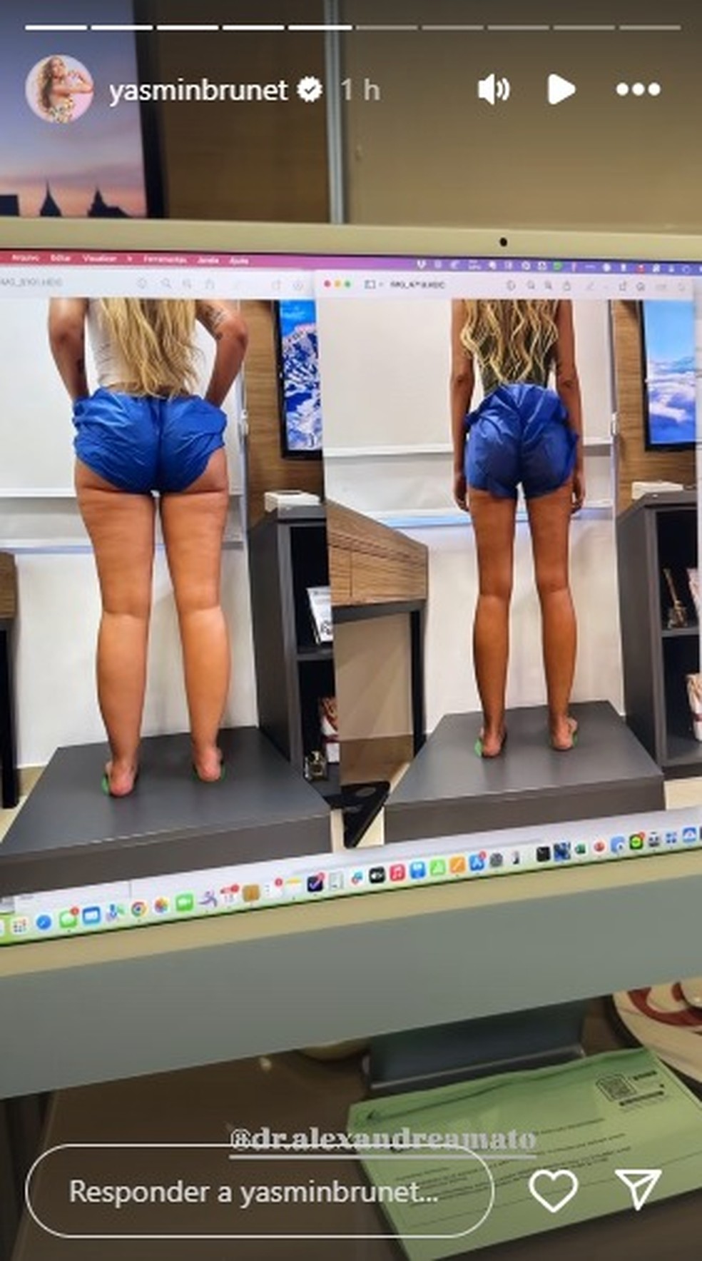 Yasmin Brunet — Foto: Reprodução/Instagram