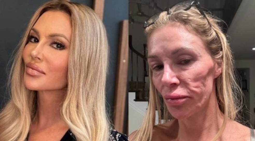 Brandi Glanville — Foto: GettyImages