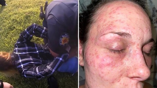 Mulher processa polícia após ser algemada com a cara em formigueiro