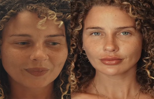 Debby Lagranha faz harmonização facial e mostra resultado: 