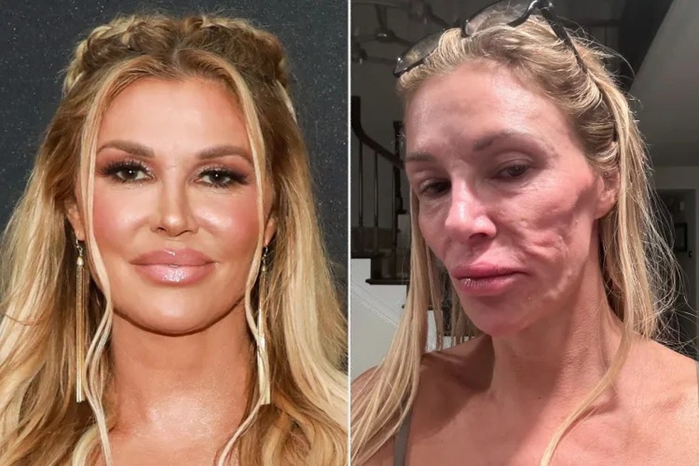 Brandi Glanville — Foto: Jason Mendez/Getty; Brandi Glanville/X
