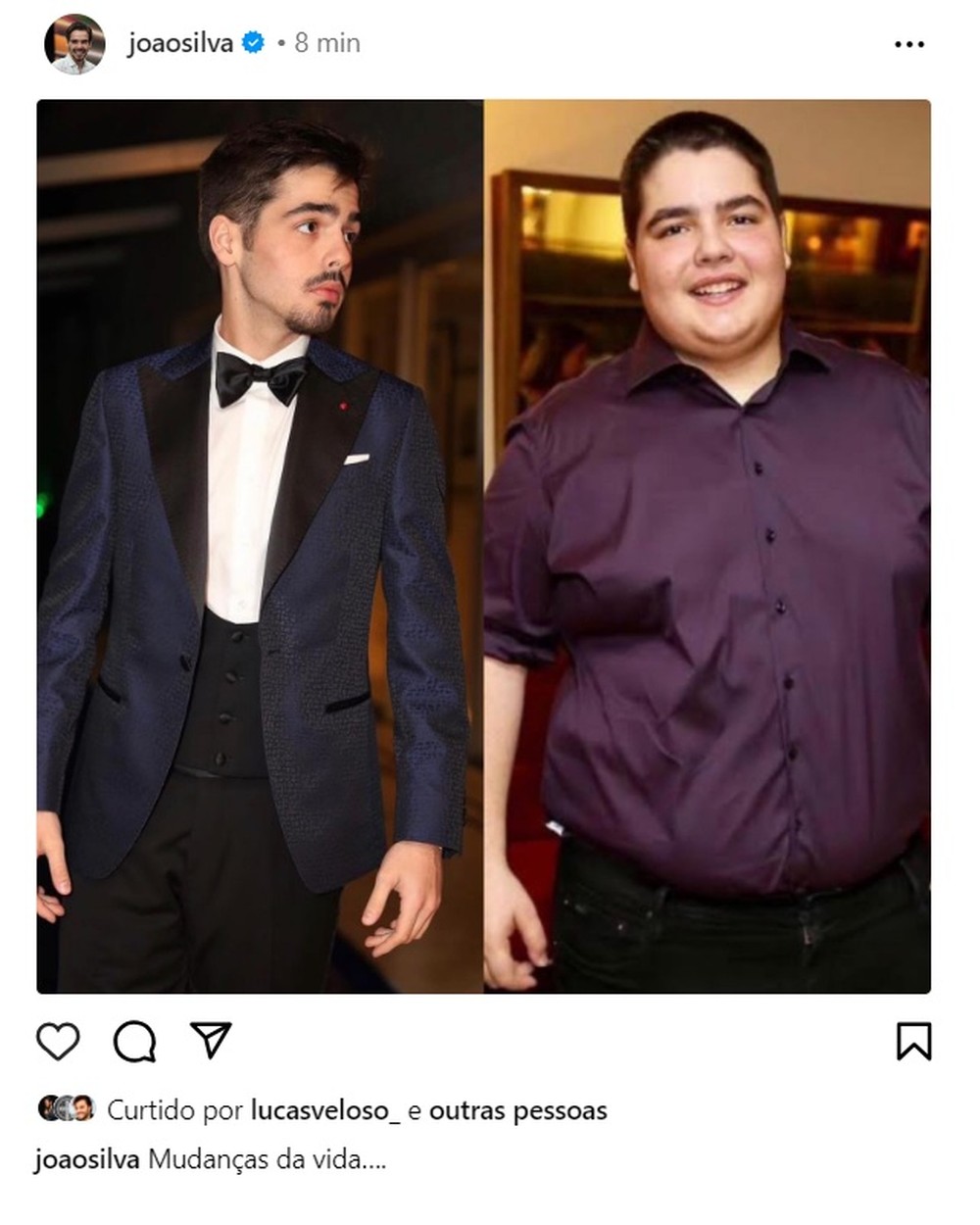 João Silva exibe antes e depois de bariátrica