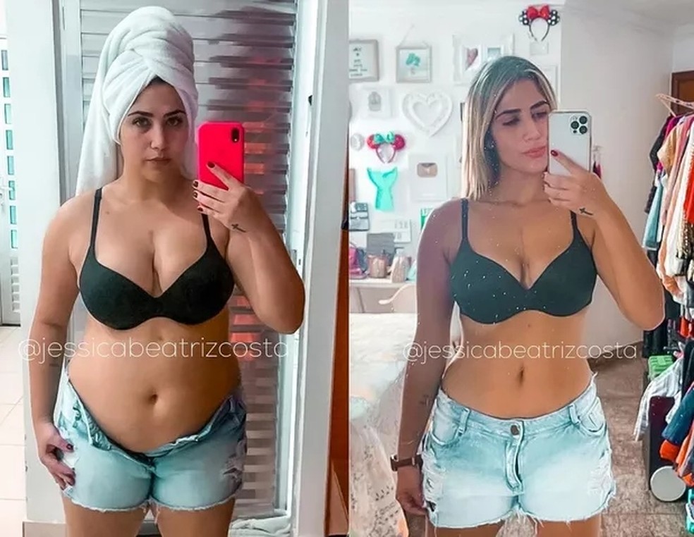 Jéssica Beatriz Costa antes e depois — Foto: Reprodução/Instagram